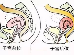 如果认为"宫颈糜烂"属慢性宫颈炎,于是用抗生素输液治疗半个月,岂不是